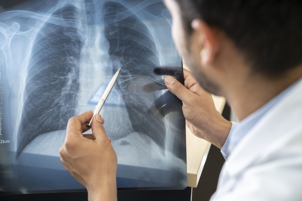 Image of doctor looking at a patients' X-Ray scan