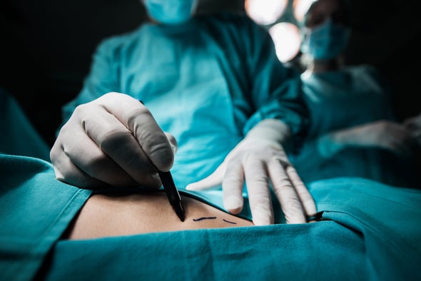 Image of a surgeon drawing lines on a patients skin